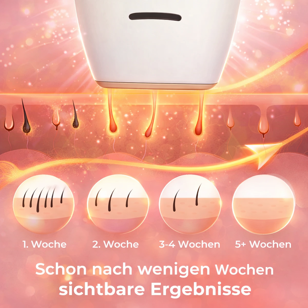 Feleva LumiPro™ IPL Haarentfernung Laser Haarentfernungsgerät Damen schmerzfrei – Bild 4